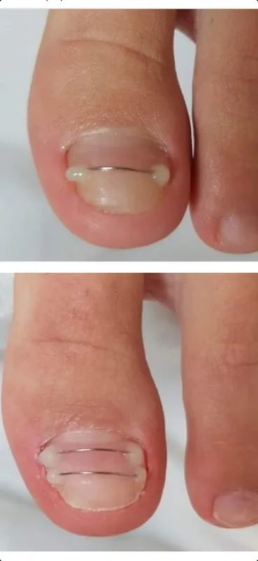 Мужской маникюр педикюр