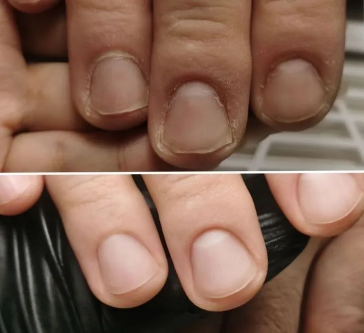 Мужской педикюр маникюр и женский Мужской педикюр маникюр и женский