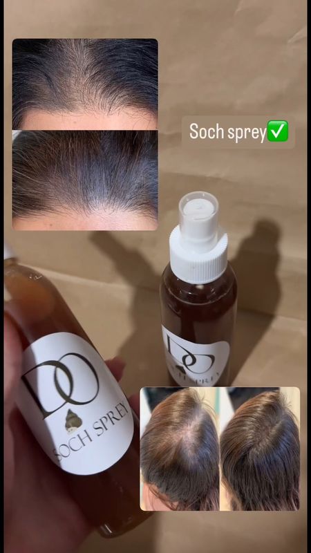 soch to’kilishini oldini oluvchi sprey soch to’kilishini oldini oluvchi sprey