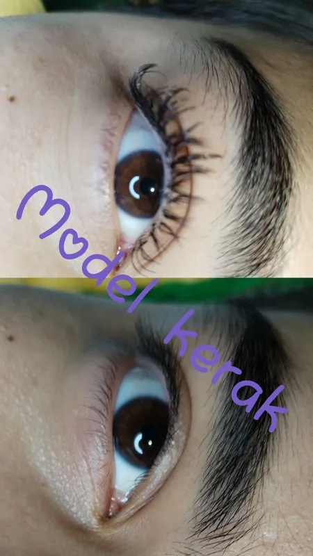 Narashevanniy kiprik Narashevanniy kiprik