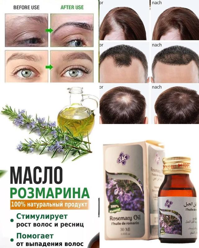ROZAMARIN YOG’I