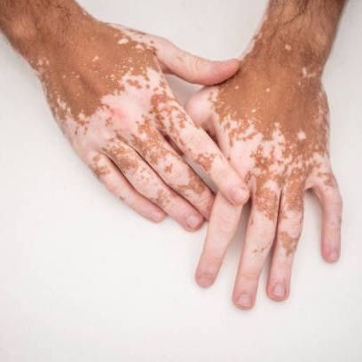 Витиколор гель / Viticolor Витиколор гель / Viticolor
