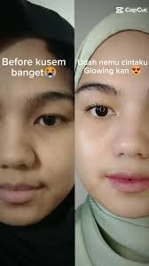 Yuzni chuqur oqartiruvchi maska Yuzni chuqur oqartiruvchi maska
