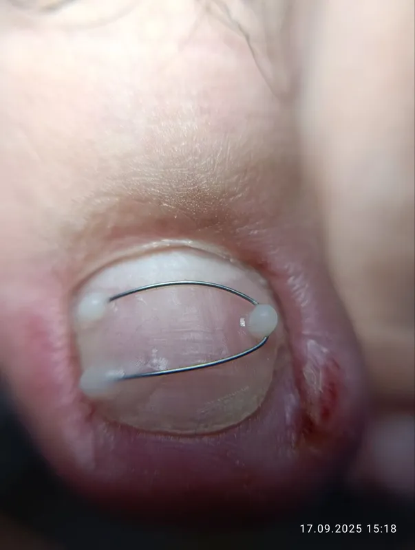 Подолог Сергели. Подолог Сергели.