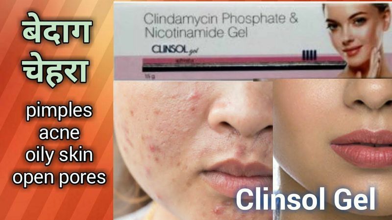 CLINSOL UGRI UGRIDAN QOLGAN DOGLARGA QARSHI KREM CLINSOL UGRI UGRIDAN QOLGAN DOGLARGA QARSHI KREM