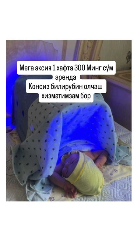 Fotolampa fototerapiya ot jeltuxi v arendu na dom Fotolampa fototerapiya ot jeltuxi v arendu na dom