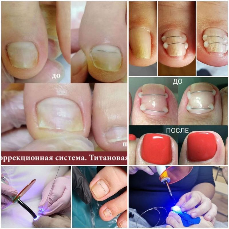 ПОДОЛОГ ,педикюр,маникюр
