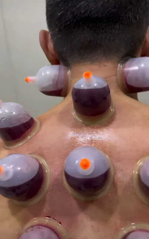 Xijoma va Zuluk muolajasi ( VIZIV xizmati ) Xijoma va Zuluk muolajasi ( VIZIV xizmati )