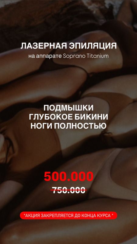 Лазерная эпиляция Лазерная эпиляция