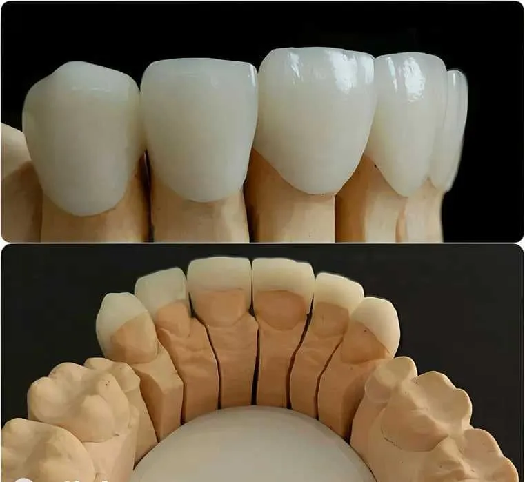 CAD/CAM цифровая зуботехническая лаборатория CAD/CAM цифровая зуботехническая лаборатория