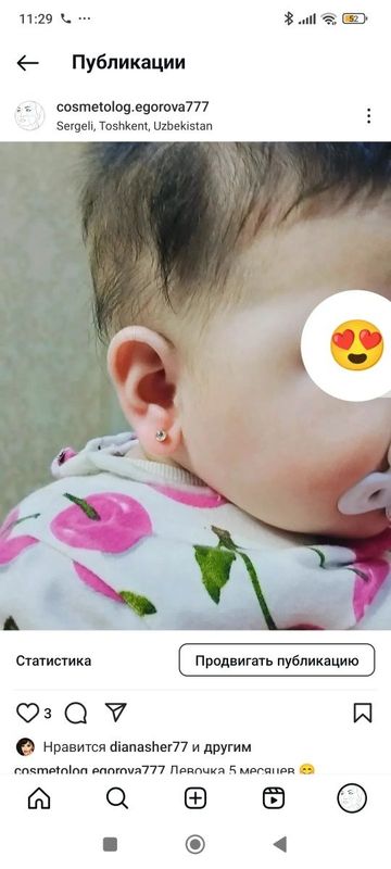 Прокалывание ушей детям Прокалывание ушей детям