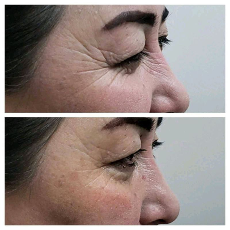 collagen collagen