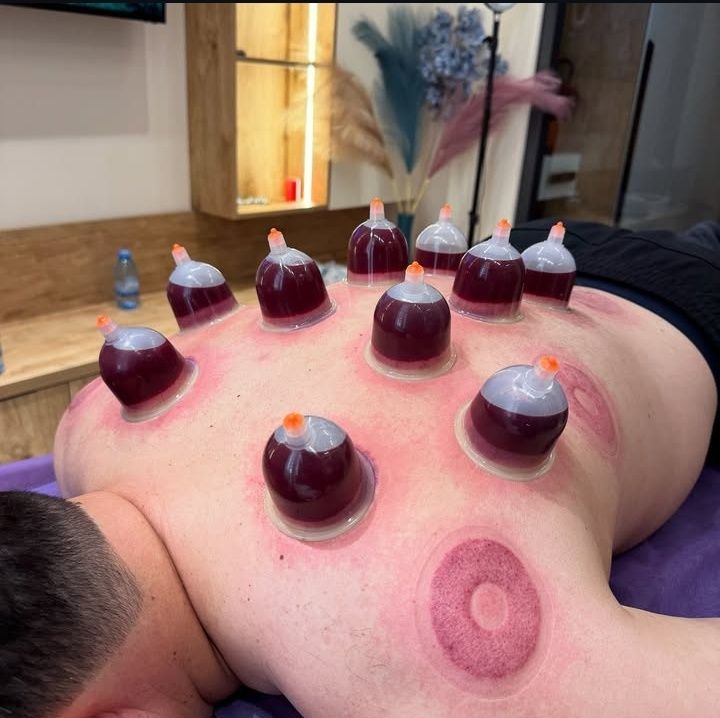 xijoma hijama uyga chaqruv