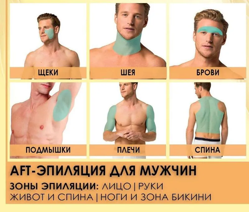 Лаезрная Эпиляция для Мужчин. AFT Удаление волос. Лаезрная Эпиляция для Мужчин. AFT Удаление волос.