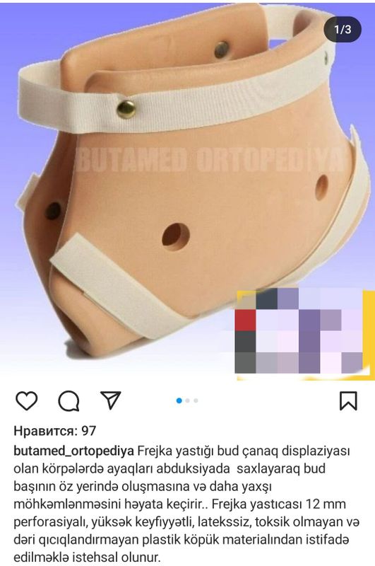 Freyka shina ortopeditiskiy Freyka shina ortopeditiskiy