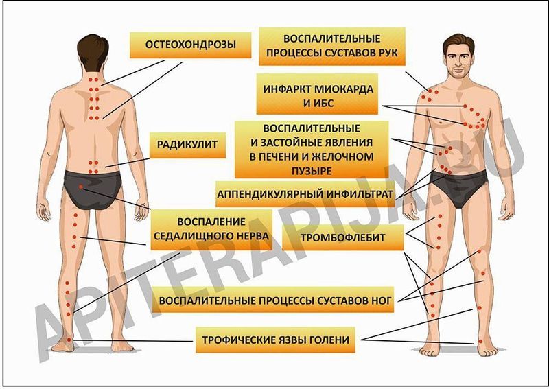 Апитерапия-асал ари билан даволаш Апитерапия-асал ари билан даволаш