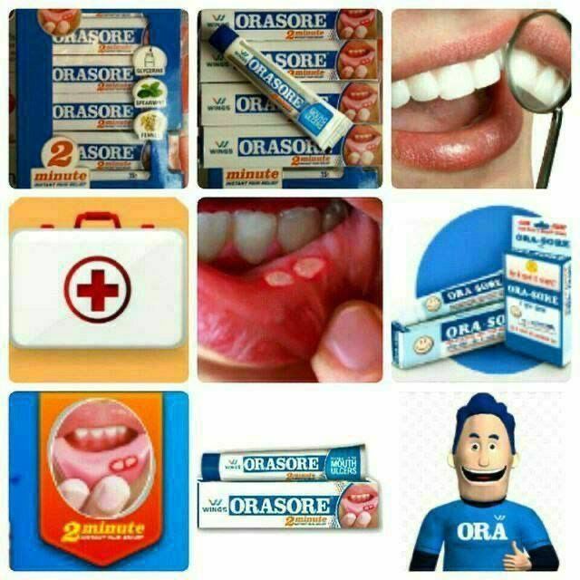 Stamatitga qarshi gel