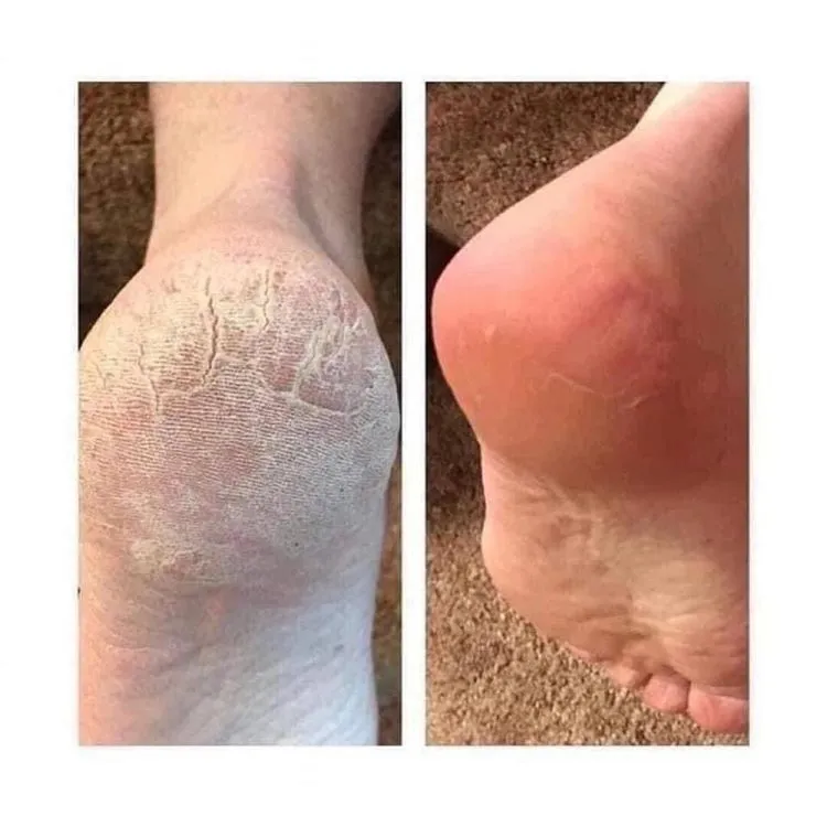 Мастер медицинского педикюра-маникюра подолог, установка Титановой нит Мастер медицинского педикюра-маникюра подолог, установка Титановой нит